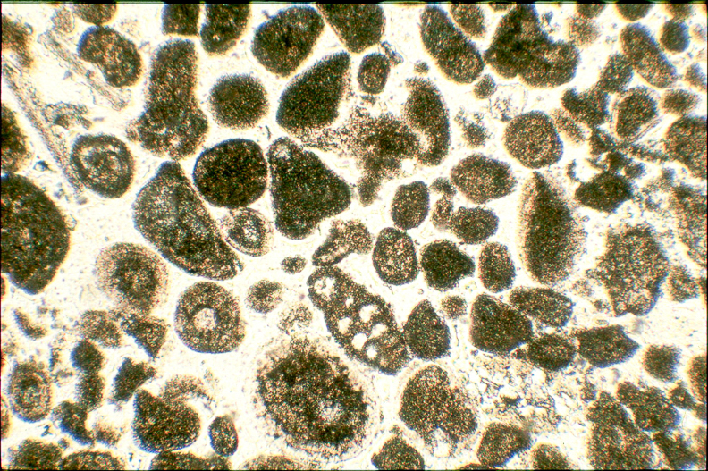 54 Estudio petrogtÃ¡fico